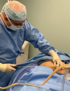 Liposuction+without+surgery