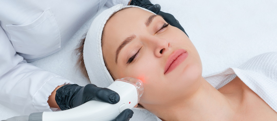 Laser and RF Skin Treatments 1 Young woman receiving laser treatment